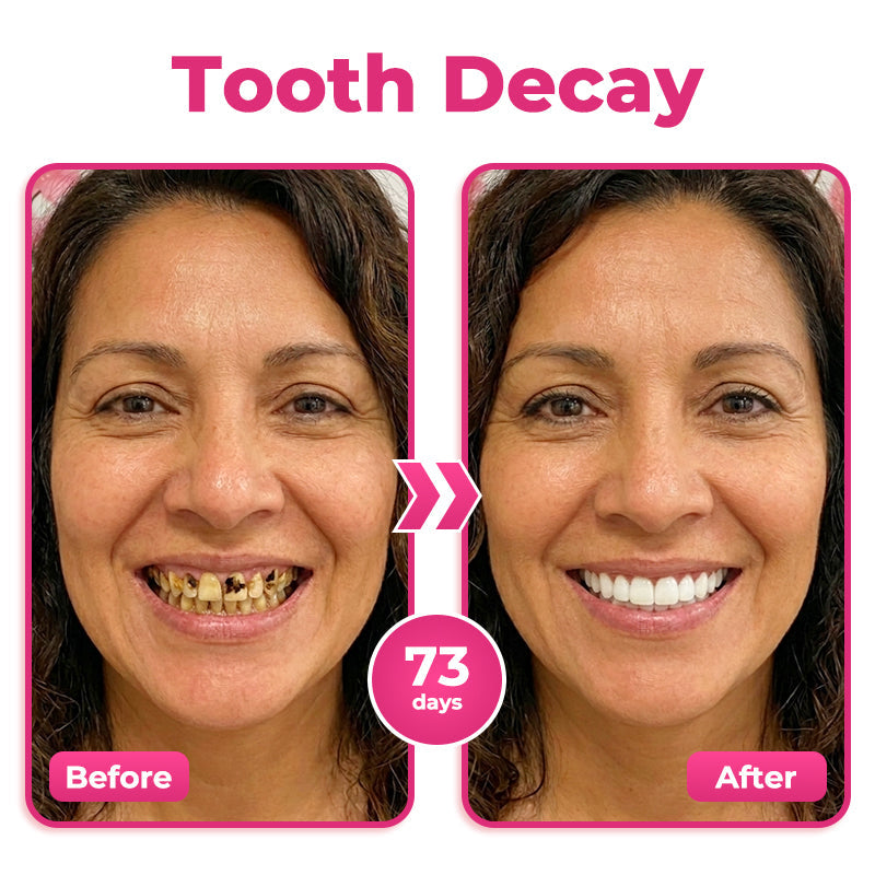 AU 🦷  Natravor® Thismile NH-10 Toothpaste Serum for Enamel & Gum Care – Advanced Therapypy