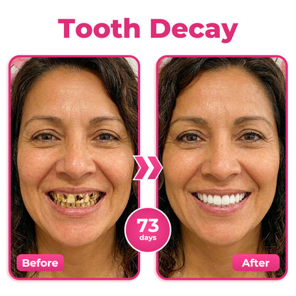 AU 🦷  Natravor® Thismile NH-10 Toothpaste Serum for Enamel & Gum Care – Advanced Therapypy