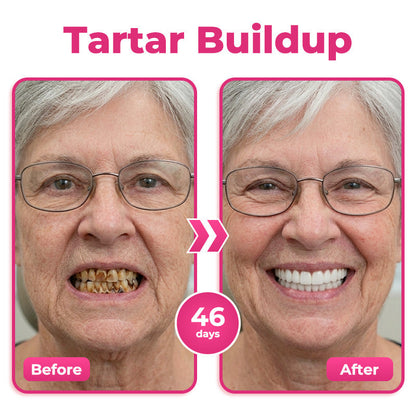 AU 🦷  Natravor® Thismile NH-10 Toothpaste Serum for Enamel & Gum Care – Advanced Therapypy