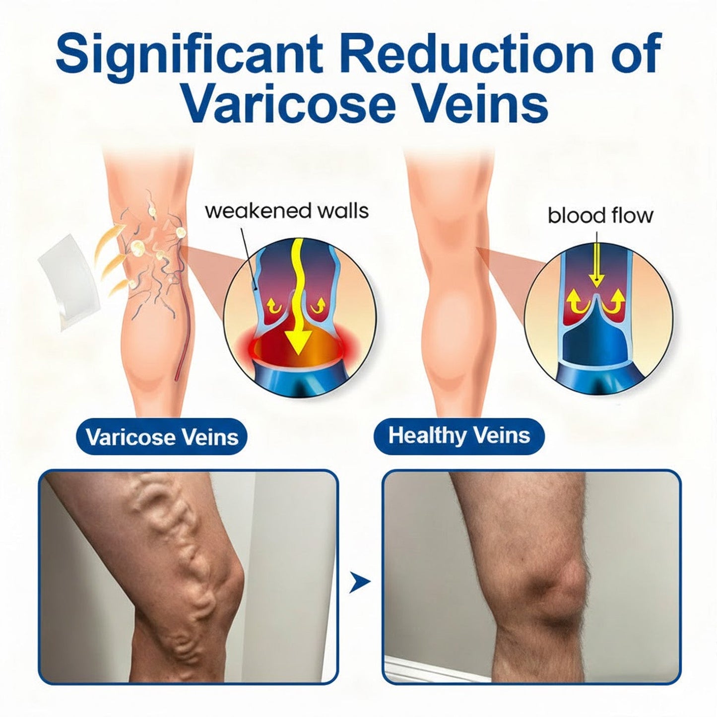 🇦🇺👨‍⚕️✅ Natravor® VeinEase Microneedle Care Patch ⚡ Fast Comfort, Lasting Leg Support
