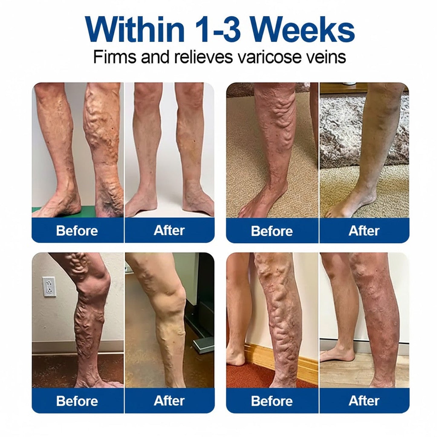 🇦🇺👨‍⚕️✅ Natravor® VeinEase Microneedle Care Patch ⚡ Fast Comfort, Lasting Leg Support